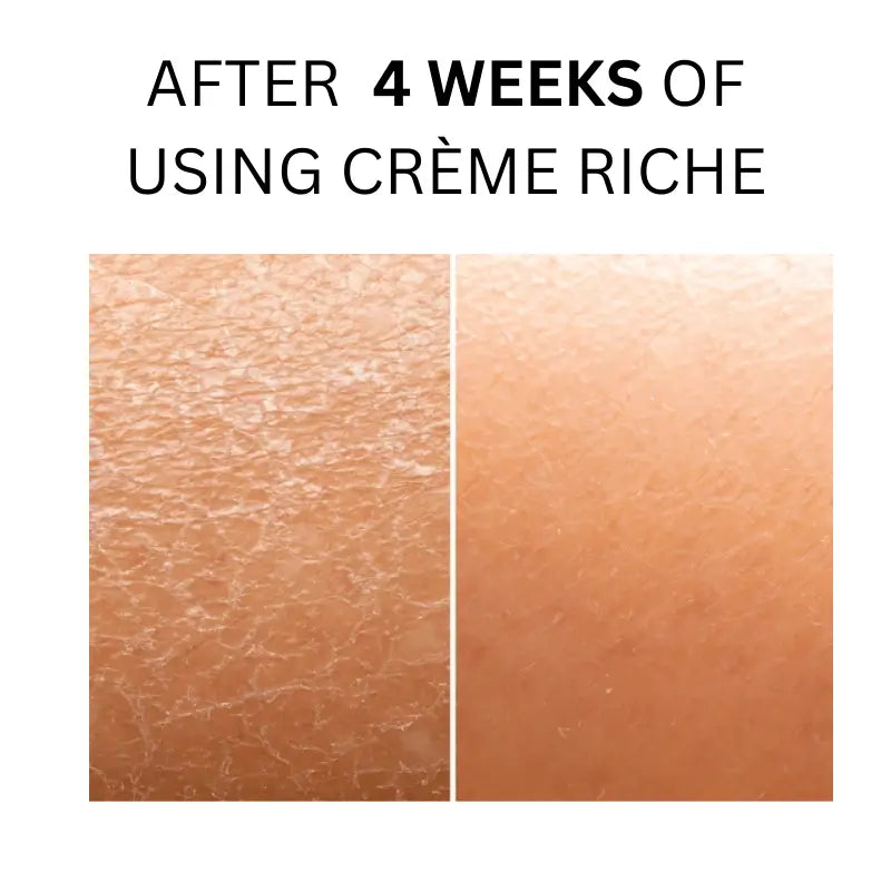 The Rich Cream: A Luxury You Can Feel, Results You Can See (1.7 fl. oz.)